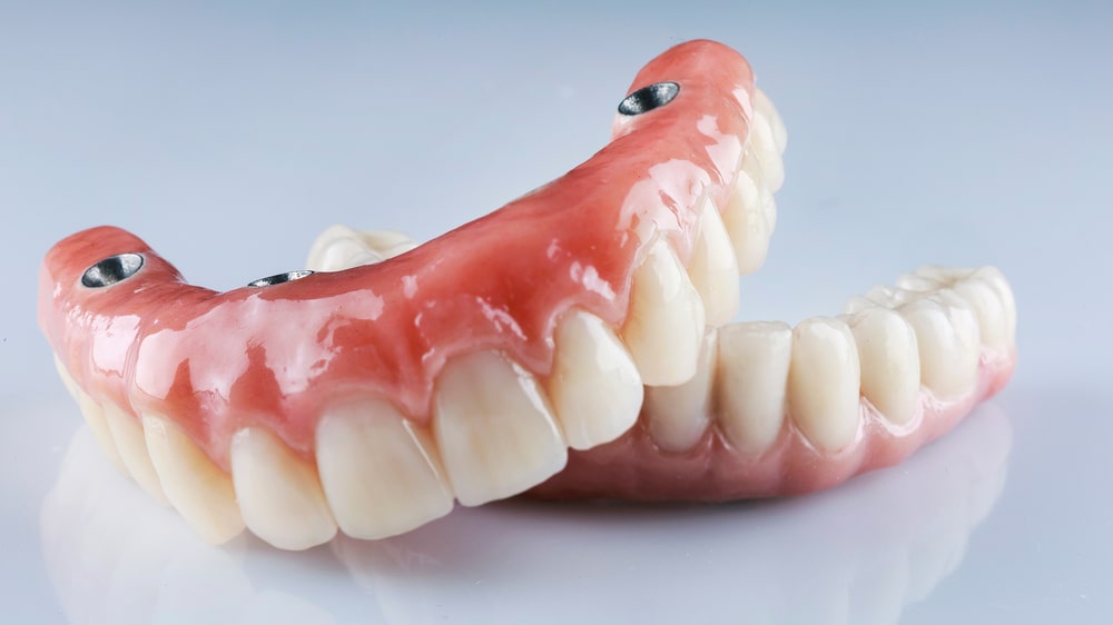 différents types de prothèses dentaires